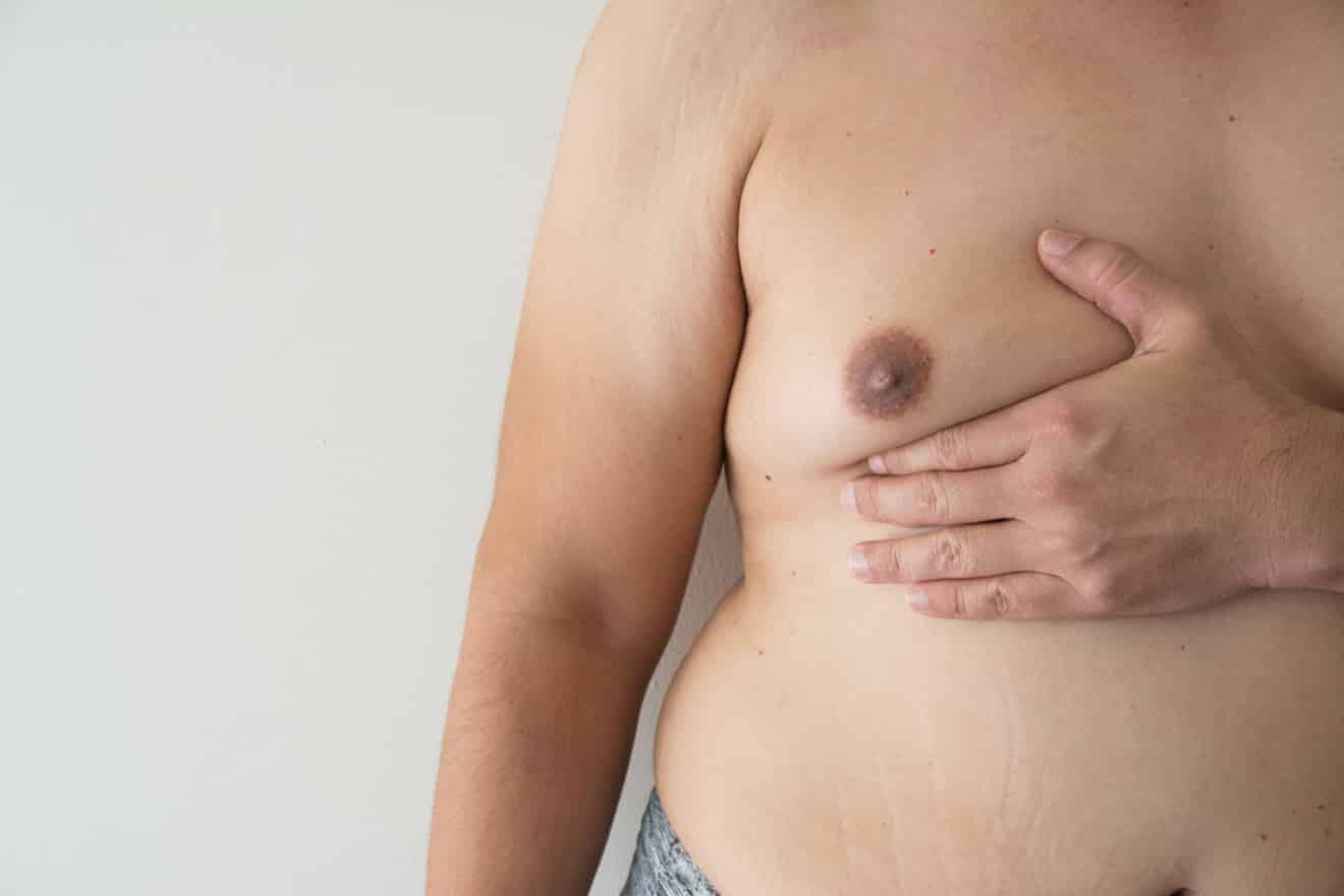 Menboobs : comment se débarrasser des seins quand on est un homme ?