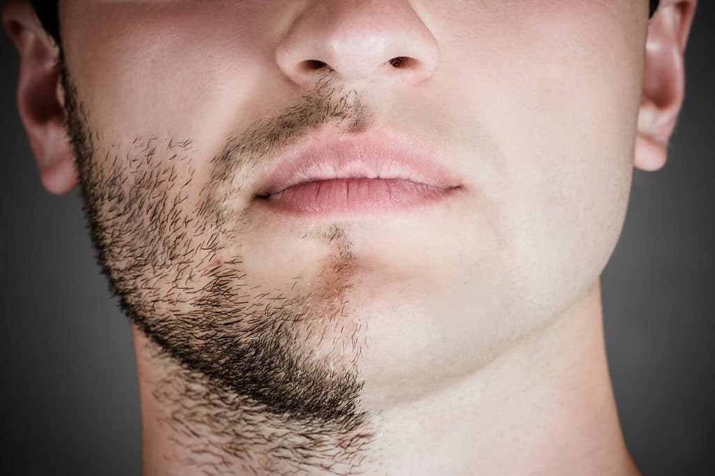 Accélérateur de pousse de barbe