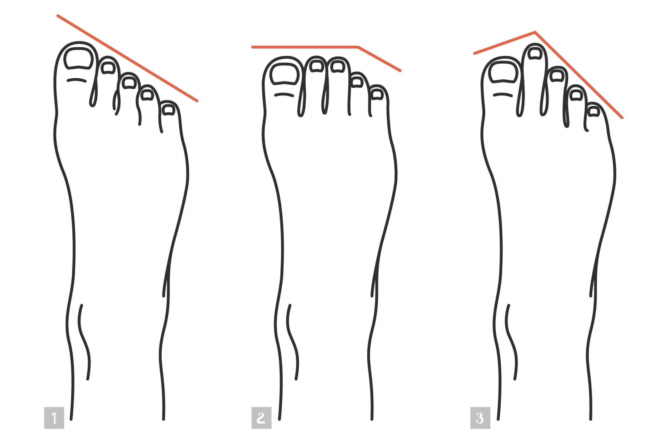 Forme des pieds