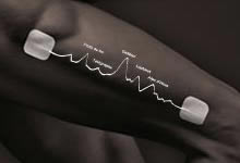 Compex Electrodes électrostimulation